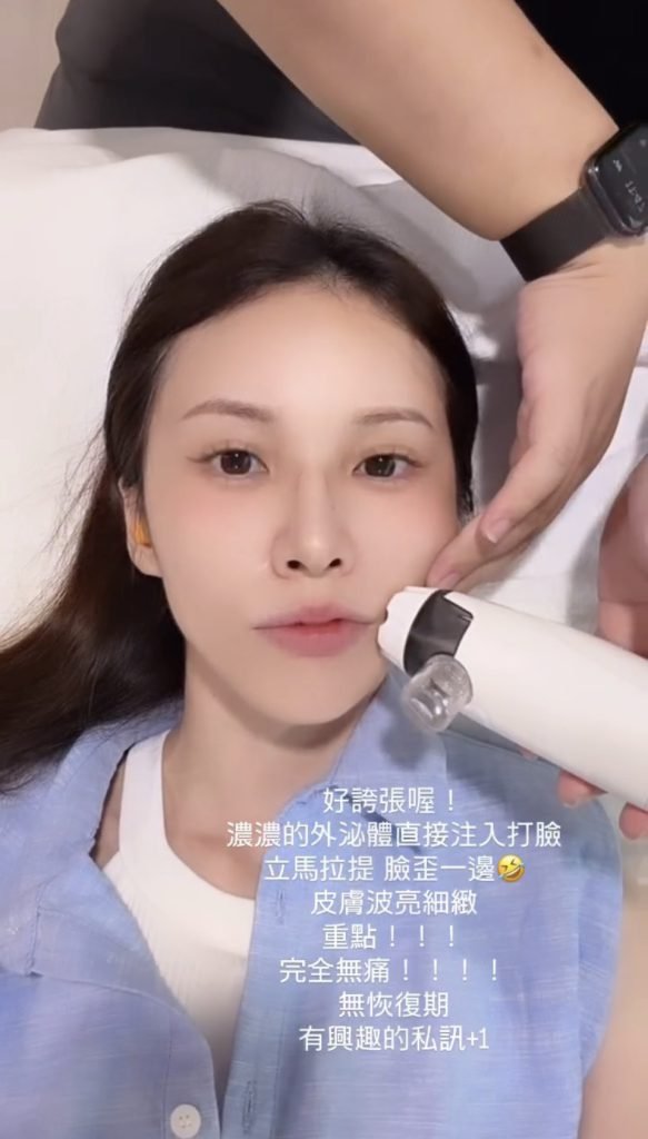 美容科技設備臉部操作的合作推廣素材